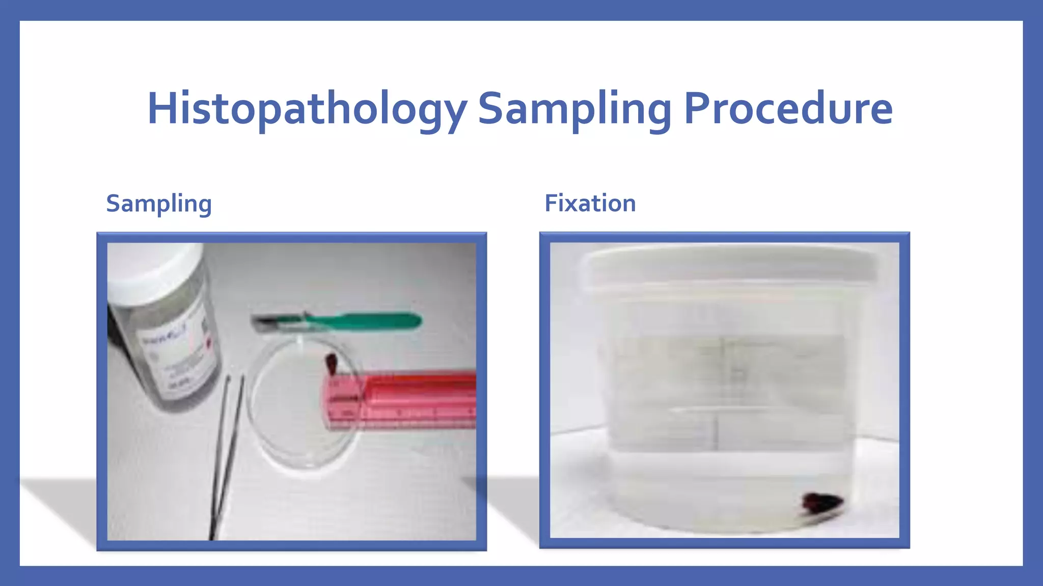 Histopathology , Sample collection to Wax infiltration (Tissue ...