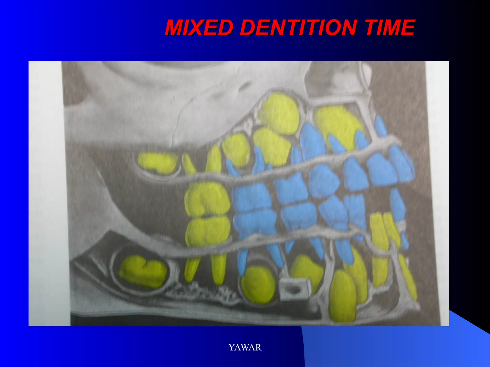 MIXED DENTITION TIME