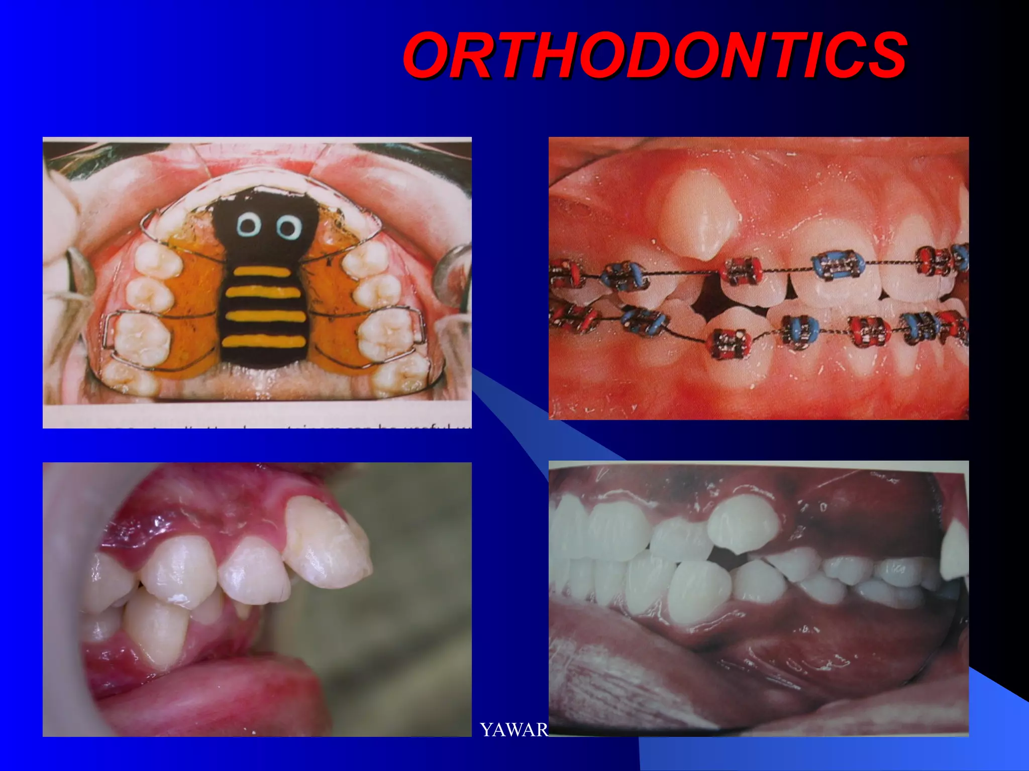 ORTHODONTICS
