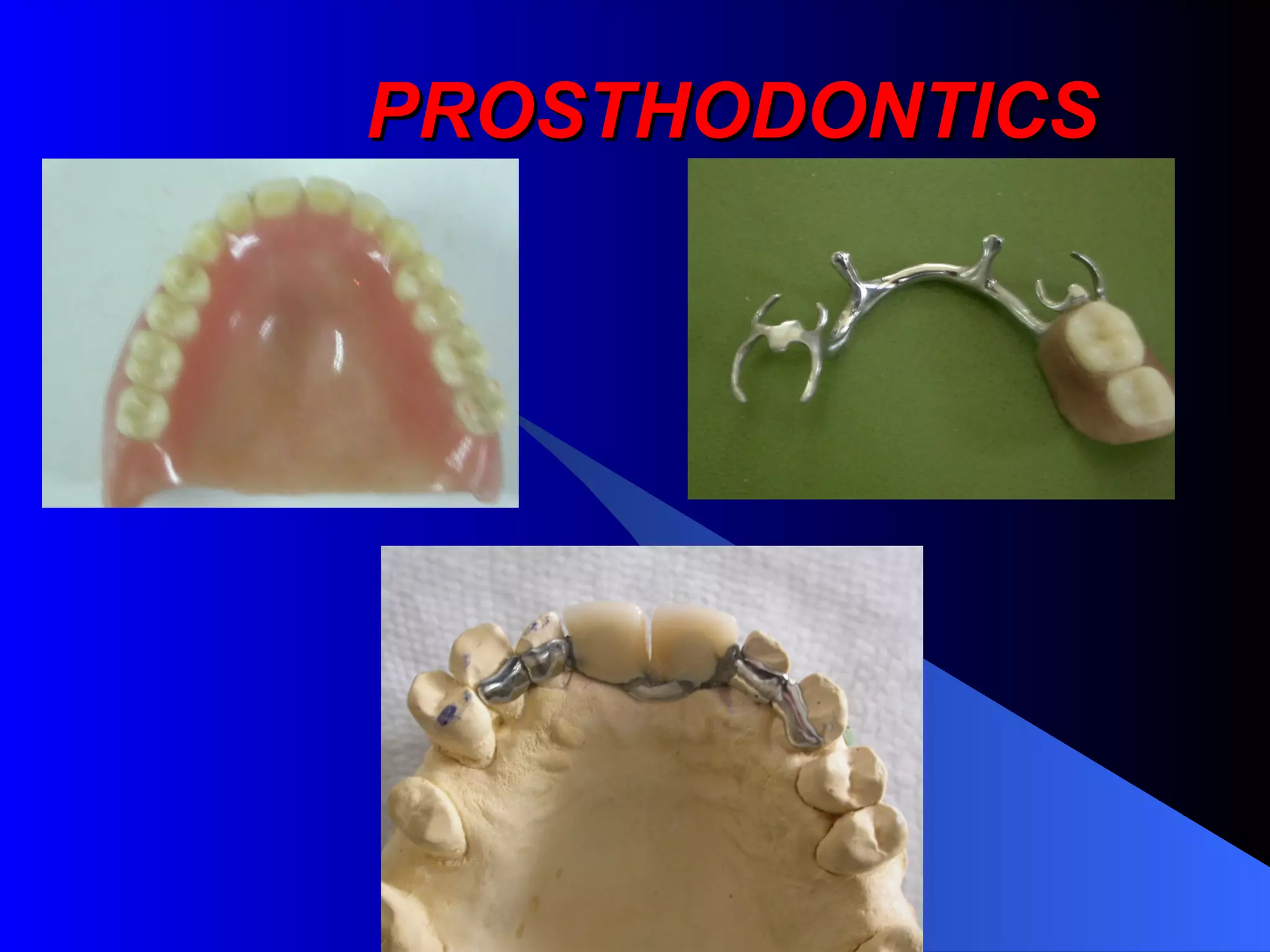 PROSTHODONTICS