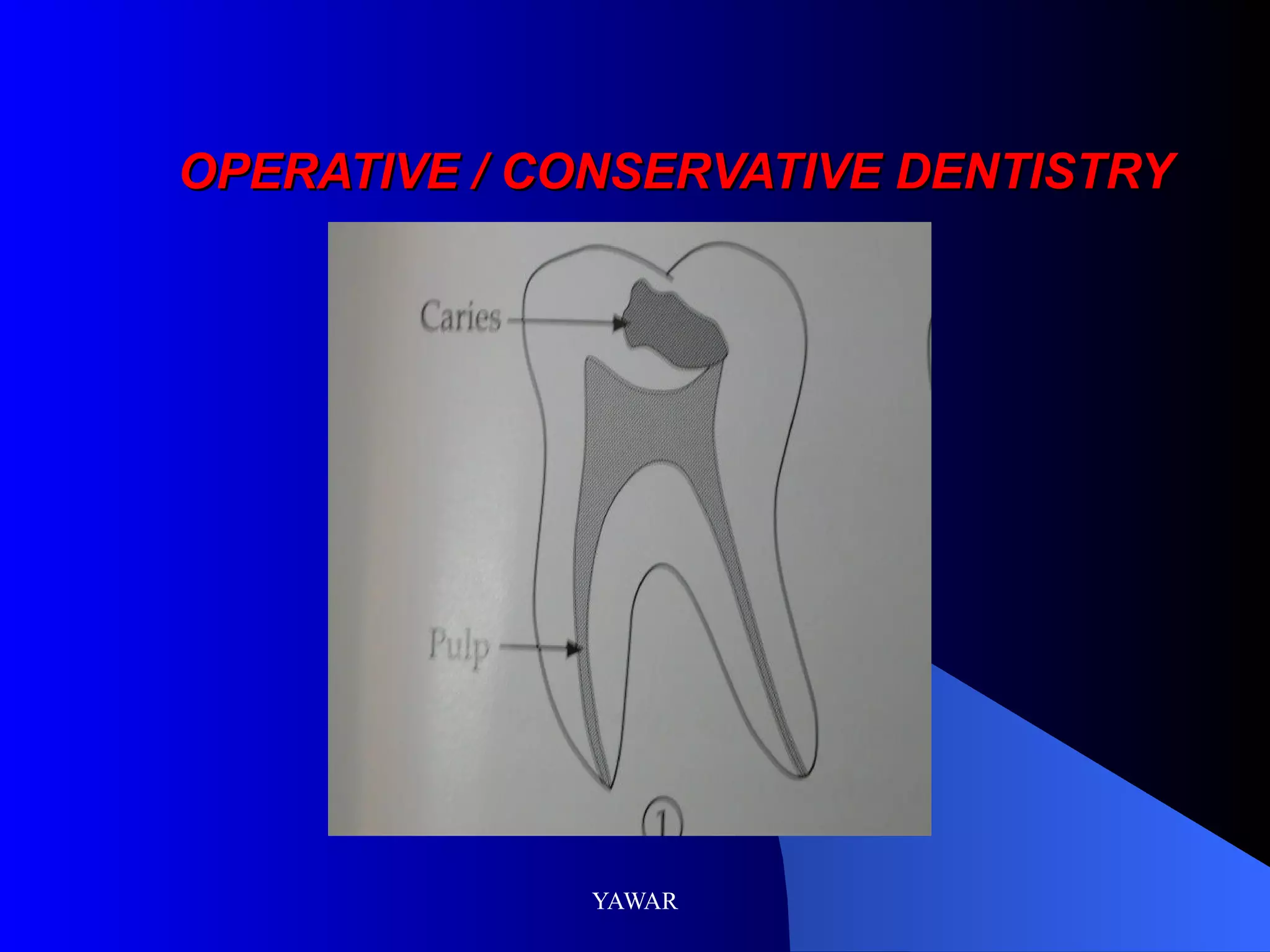 OPERATIVE / CONSERVATIVE DENTISTRY