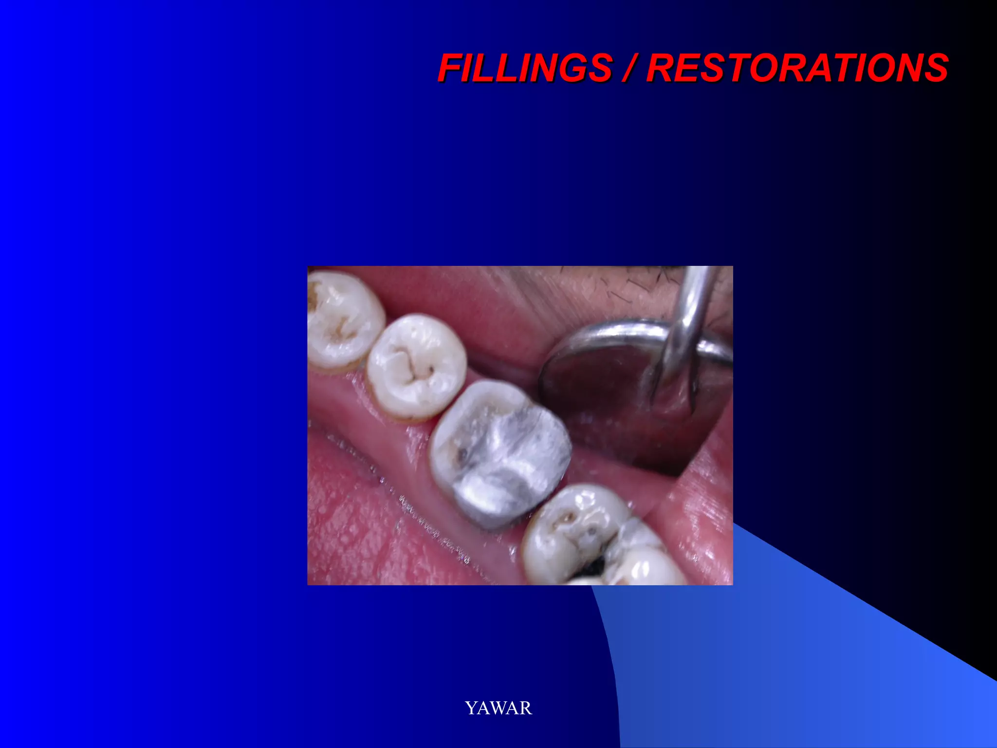 FILLINGS / RESTORATIONS
