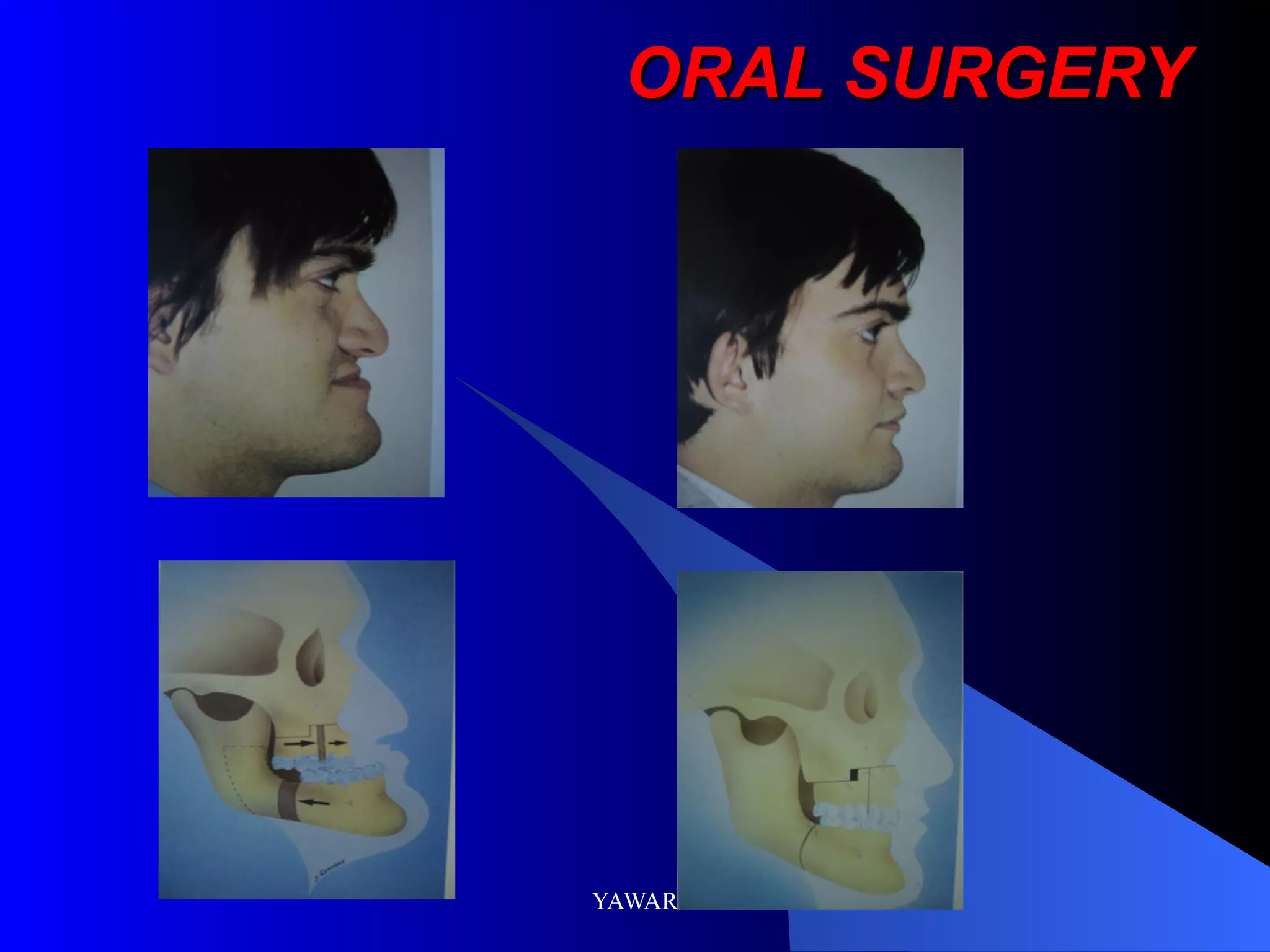 ORAL SURGERY
