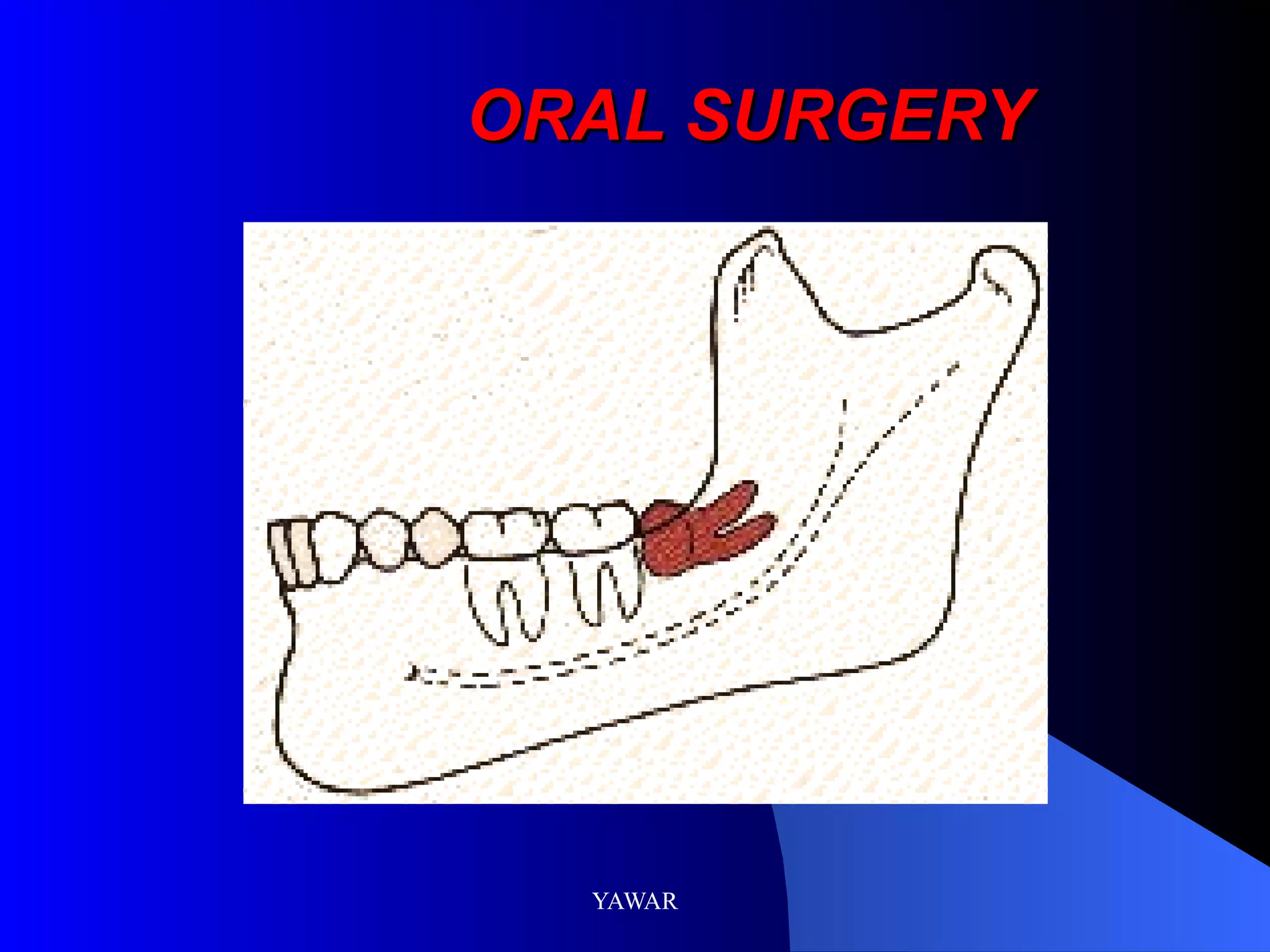 ORAL SURGERY