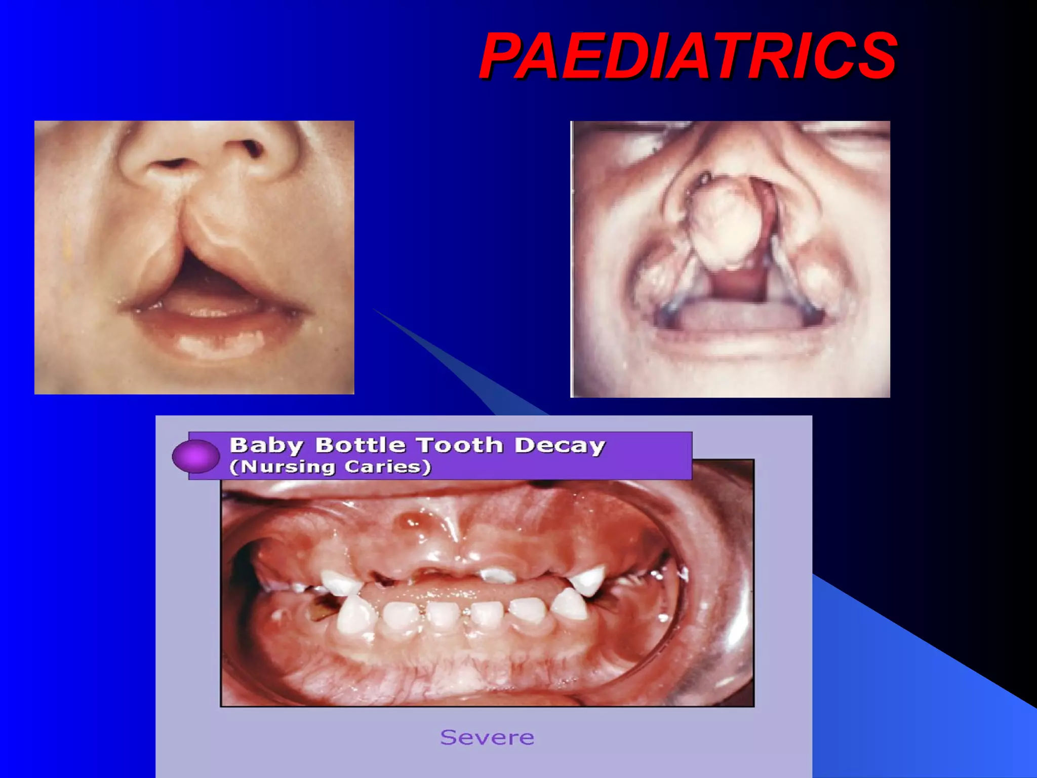 PAEDIATRICS