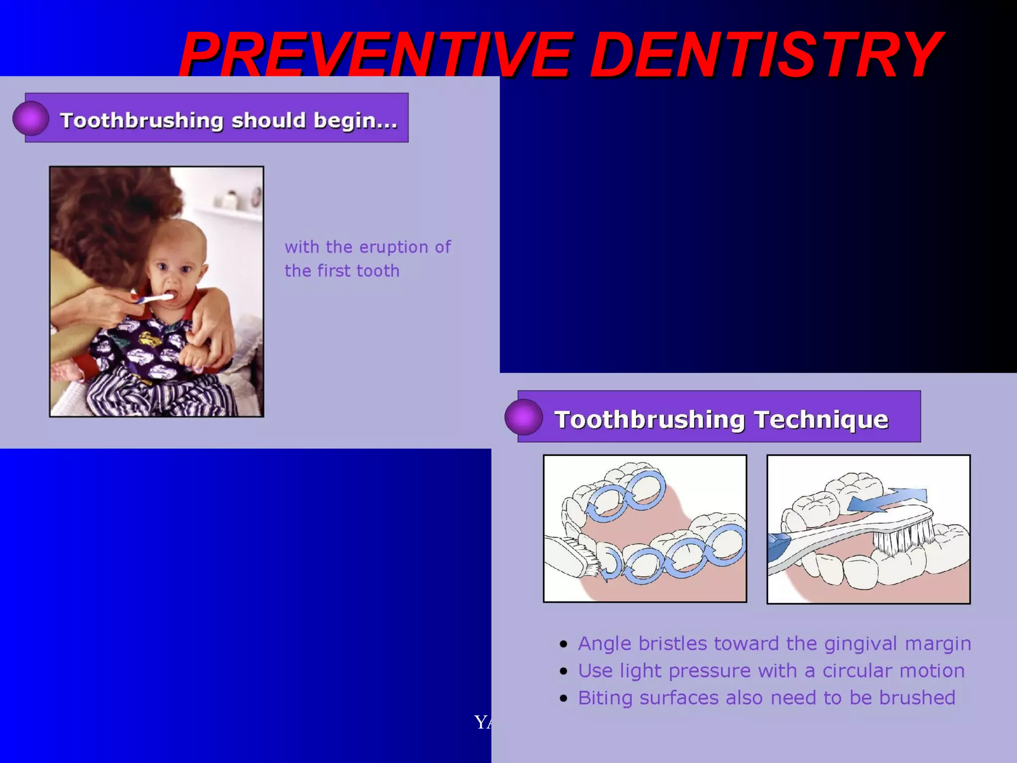 PREVENTIVE DENTISTRY