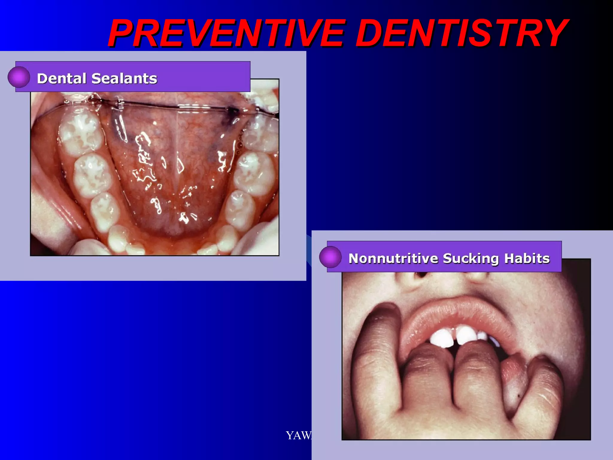 PREVENTIVE DENTISTRY