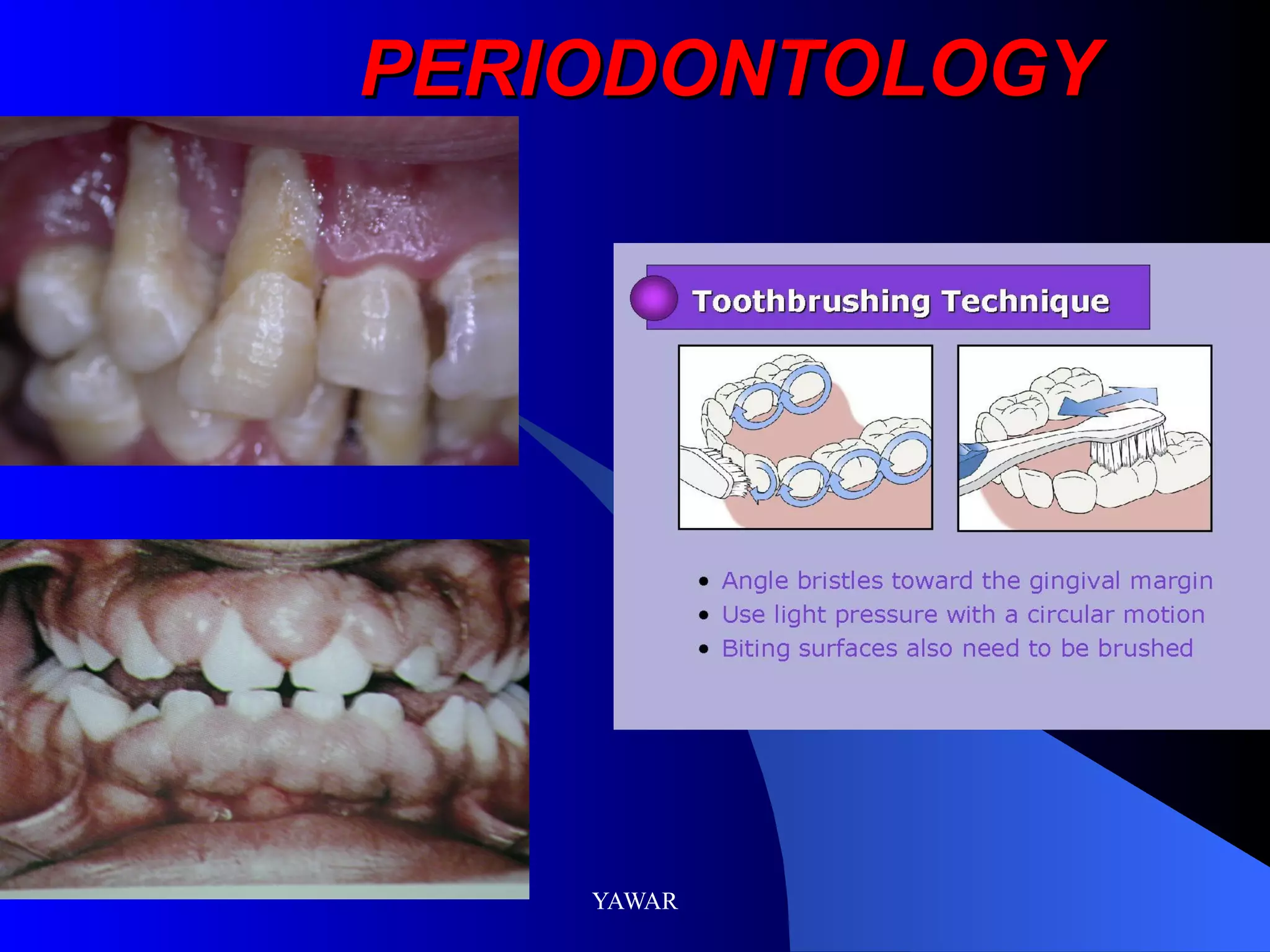 PERIODONTOLOGY