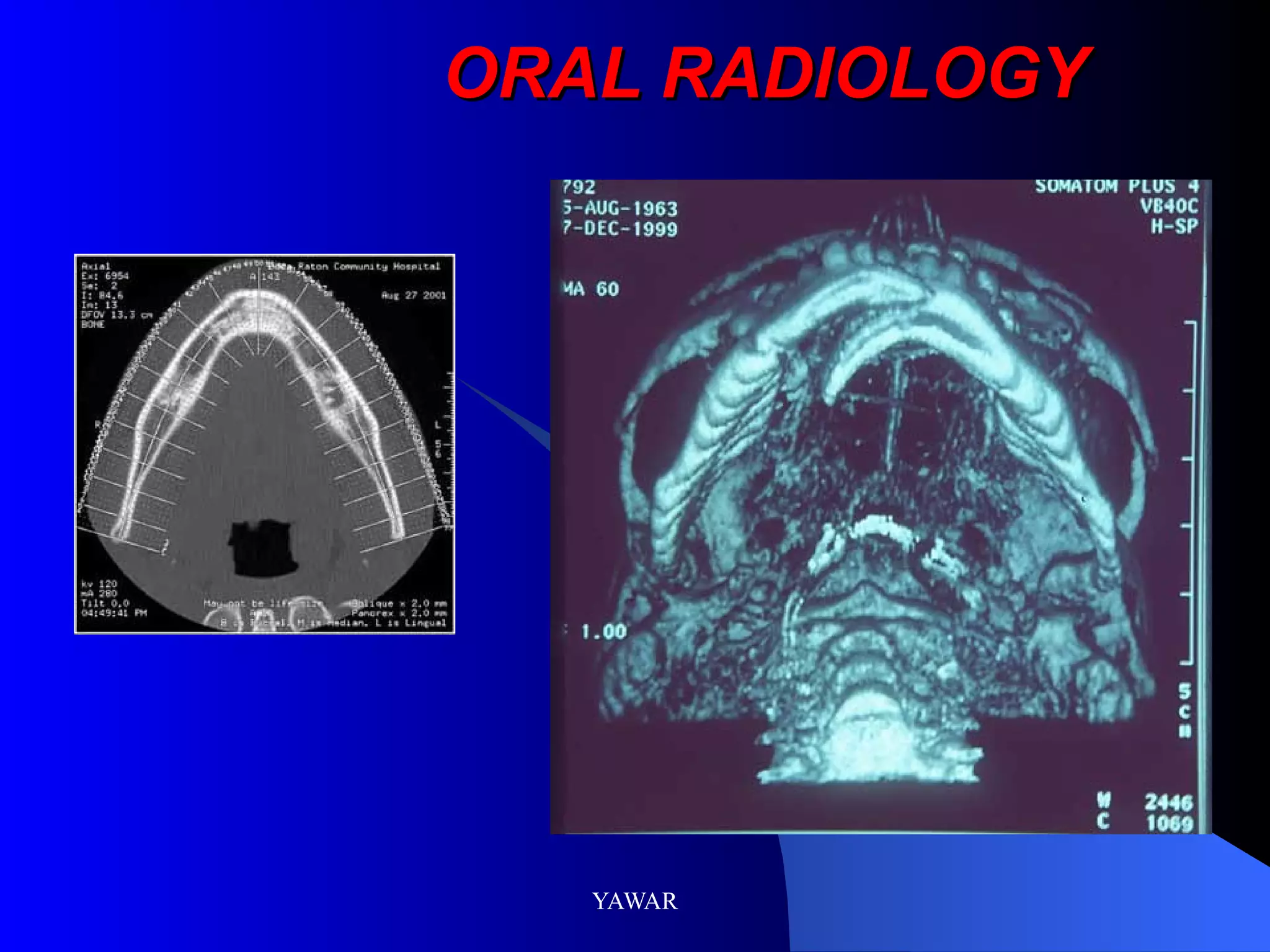 ORAL RADIOLOGY