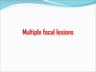 Multiple focal lesions 
