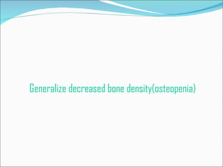 Generalize decreased bone density(osteopenia) 
