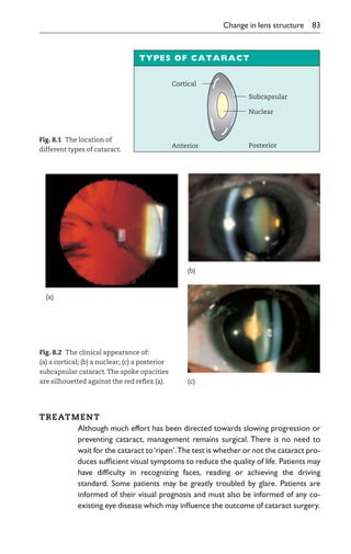 Lecture Notes on Ophthalmology.pdf