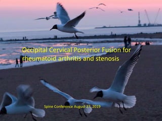 Occipital Cervical Posterior Fusion for
rheumatoid arthritis and stenosis
Spine Conference August 27, 2019
 