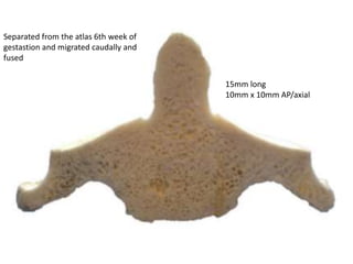 Separated from the atlas 6th week of
gestastion and migrated caudally and
fused
15mm long
10mm x 10mm AP/axial
 