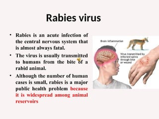 Lecture of Virology (Rabies)with Audio.ppt