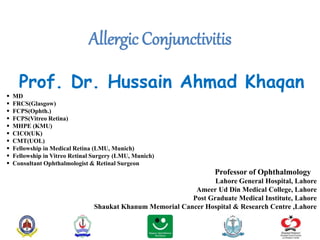 Allergic Conjunctivitis
Prof. Dr. Hussain Ahmad Khaqan
 MD
 FRCS(Glasgow)
 FCPS(Ophth.)
 FCPS(Vitreo Retina)
 MHPE (KMU)
 CICO(UK)
 CMT(UOL)
 Fellowship in Medical Retina (LMU, Munich)
 Fellowship in Vitreo Retinal Surgery (LMU, Munich)
 Consultant Ophthalmologist & Retinal Surgeon
Professor of Ophthalmology
Lahore General Hospital, Lahore
Ameer Ud Din Medical College, Lahore
Post Graduate Medical Institute, Lahore
Shaukat Khanum Memorial Cancer Hospital & Research Centre ,Lahore
 
