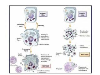Principles of cell injury and cellular adaptation .ppt Slide 36