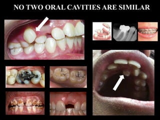 NO TWO ORAL CAVITIES ARE SIMILAR
 