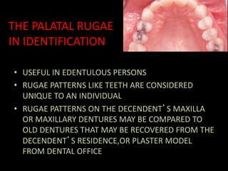 THE PALATAL RUGAE
IN IDENTIFICATION
• USEFUL IN EDENTULOUS PERSONS
• RUGAE PATTERNS LIKE TEETH ARE CONSIDERED
UNIQUE TO AN INDIVIDUAL
• RUGAE PATTERNS ON THE DECENDENT’S MAXILLA
OR MAXILLARY DENTURES MAY BE COMPARED TO
OLD DENTURES THAT MAY BE RECOVERED FROM THE
DECENDENT’S RESIDENCE,OR PLASTER MODEL
FROM DENTAL OFFICE
 