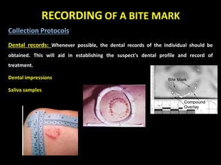 Collection Protocols
Dental records: Whenever possible, the dental records of the individual should be
obtained. This will aid in establishing the suspect's dental profile and record of
treatment.
Dental impressions
Saliva samples
 