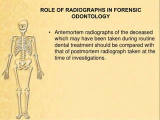 ROLE OF RADIOGRAPHS IN FORENSIC
ODONTOLOGY
 