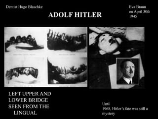 ADOLF HITLER
LEFT UPPER AND
LOWER BRIDGE
SEEN FROM THE
LINGUAL
Eva Braun
on April 30th
1945
Until
1968, Hitler’s fate was still a
mystery
Dentist Hugo Blaschke
 