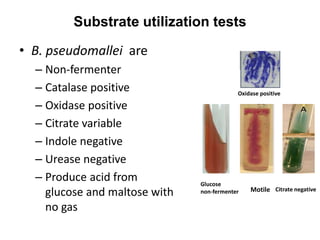 Indole Negative Urease Positive lecture on melioidosis 04-08-21.pptx