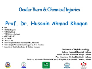 Ocular Burn & Chemical Injuries
Prof. Dr. Hussain Ahmad Khaqan
 MD
 FRCS(Glasgow)
 FCPS(Ophth.)
 FCPS(Vitreo Retina)
 MHPE (KMU)
 CICO(UK)
 CMT(UOL)
 Fellowship in Medical Retina (LMU, Munich)
 Fellowship in Vitreo Retinal Surgery (LMU, Munich)
 Consultant Ophthalmologist & Retinal Surgeon
Professor of Ophthalmology
Lahore General Hospital, Lahore
Ameer Ud Din Medical College, Lahore
Post Graduate Medical Institute, Lahore
Shaukat Khanum Memorial Cancer Hospital & Research Centre ,Lahore
 