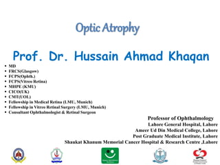 Optic Atrophy
Prof. Dr. Hussain Ahmad Khaqan
 MD
 FRCS(Glasgow)
 FCPS(Ophth.)
 FCPS(Vitreo Retina)
 MHPE (KMU)
 CICO(UK)
 CMT(UOL)
 Fellowship in Medical Retina (LMU, Munich)
 Fellowship in Vitreo Retinal Surgery (LMU, Munich)
 Consultant Ophthalmologist & Retinal Surgeon
Professor of Ophthalmology
Lahore General Hospital, Lahore
Ameer Ud Din Medical College, Lahore
Post Graduate Medical Institute, Lahore
Shaukat Khanum Memorial Cancer Hospital & Research Centre ,Lahore
 