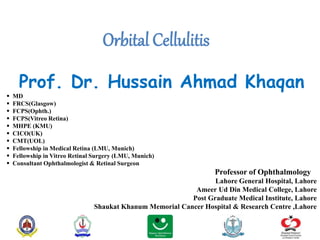 Orbital Cellulitis
Prof. Dr. Hussain Ahmad Khaqan
 MD
 FRCS(Glasgow)
 FCPS(Ophth.)
 FCPS(Vitreo Retina)
 MHPE (KMU)
 CICO(UK)
 CMT(UOL)
 Fellowship in Medical Retina (LMU, Munich)
 Fellowship in Vitreo Retinal Surgery (LMU, Munich)
 Consultant Ophthalmologist & Retinal Surgeon
Professor of Ophthalmology
Lahore General Hospital, Lahore
Ameer Ud Din Medical College, Lahore
Post Graduate Medical Institute, Lahore
Shaukat Khanum Memorial Cancer Hospital & Research Centre ,Lahore
 