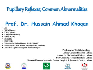 Pupillary Reflexes; Common Abnormalities
Prof. Dr. Hussain Ahmad Khaqan
 MD
 FRCS(Glasgow)
 FCPS(Ophth.)
 FCPS(Vitreo Retina)
 MHPE (KMU)
 CICO(UK)
 CMT(UOL)
 Fellowship in Medical Retina (LMU, Munich)
 Fellowship in Vitreo Retinal Surgery (LMU, Munich)
 Consultant Ophthalmologist & Retinal Surgeon
Professor of Ophthalmology
Lahore General Hospital, Lahore
Ameer Ud Din Medical College, Lahore
Post Graduate Medical Institute, Lahore
Shaukat Khanum Memorial Cancer Hospital & Research Centre ,Lahore
 