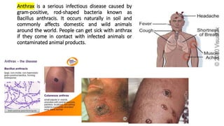 LECTURE ON SKIN DISEASES.pptx
