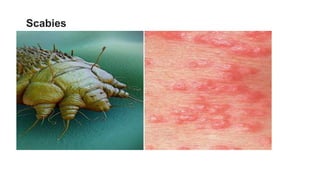 LECTURE ON SKIN DISEASES.pptx