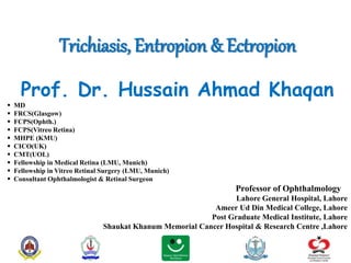 Trichiasis, Entropion & Ectropion
Prof. Dr. Hussain Ahmad Khaqan
 MD
 FRCS(Glasgow)
 FCPS(Ophth.)
 FCPS(Vitreo Retina)
 MHPE (KMU)
 CICO(UK)
 CMT(UOL)
 Fellowship in Medical Retina (LMU, Munich)
 Fellowship in Vitreo Retinal Surgery (LMU, Munich)
 Consultant Ophthalmologist & Retinal Surgeon
Professor of Ophthalmology
Lahore General Hospital, Lahore
Ameer Ud Din Medical College, Lahore
Post Graduate Medical Institute, Lahore
Shaukat Khanum Memorial Cancer Hospital & Research Centre ,Lahore
 