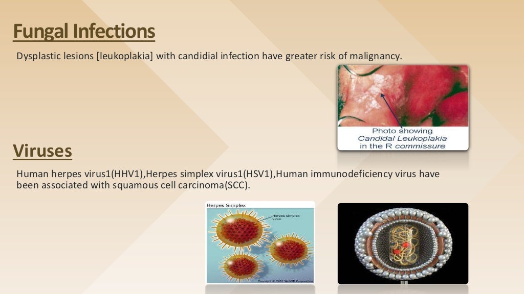 EPIDEMIOLOGY OF ORAL CANCER