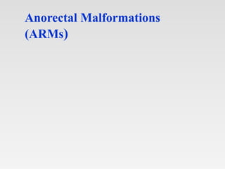 Anorectal Malformations
(ARMs)
 