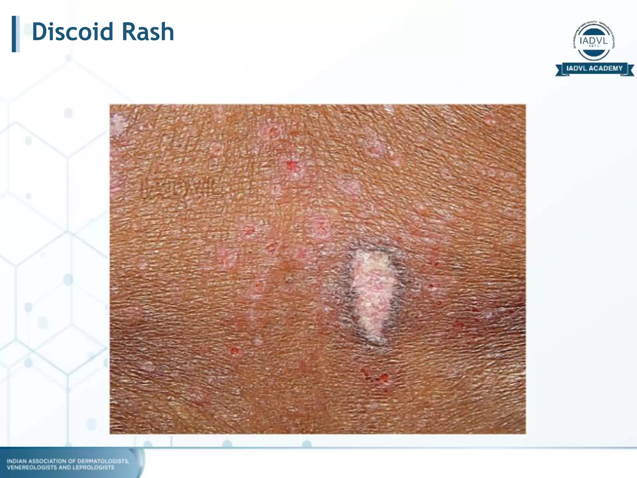 Lecture physiotherapy.pptx