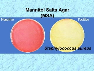 Mannitol Salts Agar
(MSA)
Staphylococcus aureus
 