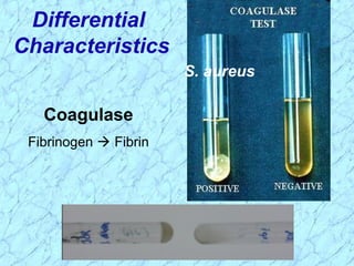 S. aureus
Coagulase
Fibrinogen  Fibrin
Differential
Characteristics
 