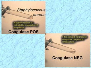 Coagulase NEG
Coagulase POS
Staphylococcus
aureus
 