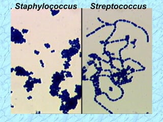 StreptococcusStaphylococcus
 