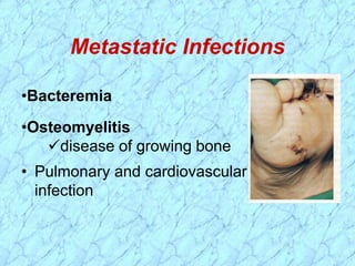Metastatic Infections
•Bacteremia
•Osteomyelitis
disease of growing bone
• Pulmonary and cardiovascular
infection
 