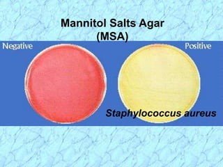 Mannitol Salts Agar
(MSA)
Staphylococcus aureus
 