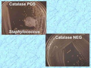 Catalase POS
Staphylococcus
Catalase NEG
 