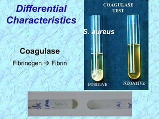 S. aureus
Coagulase
Fibrinogen  Fibrin
Differential
Characteristics
 
