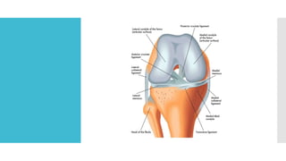 Tibia Proksimal fractures of proximal tibia.pptx