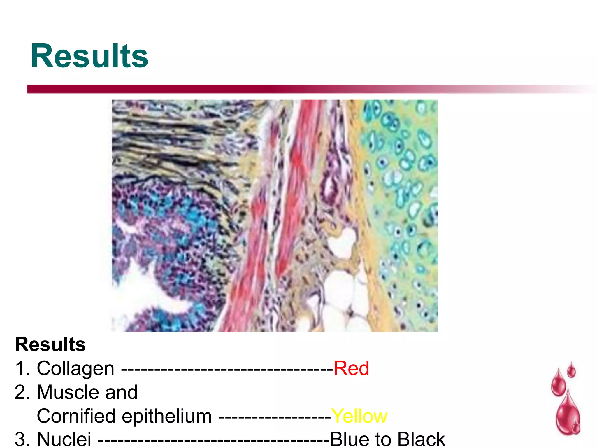 Results
Results
1. Collagen --------------------------------Red
2. Muscle and
Cornified epithelium -----------------Yellow
3. Nuclei -----------------------------------Blue to Black
 