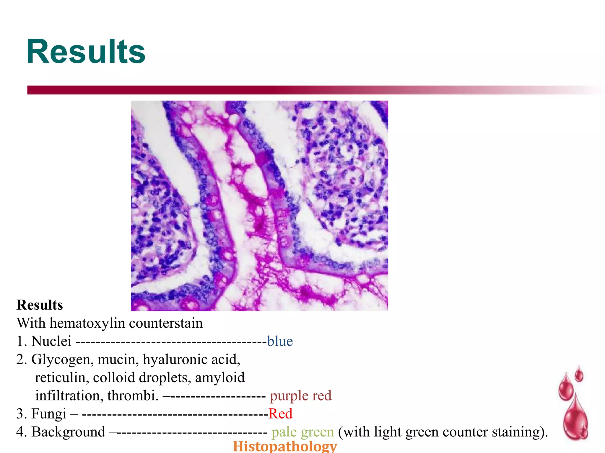 Results
Results
With hematoxylin counterstain
1. Nuclei --------------------------------------blue
2. Glycogen, mucin, hyaluronic acid,
reticulin, colloid droplets, amyloid
infiltration, thrombi. –------------------- purple red
3. Fungi – -------------------------------------Red
4. Background –------------------------------ pale green (with light green counter staining).
Histopathology
 
