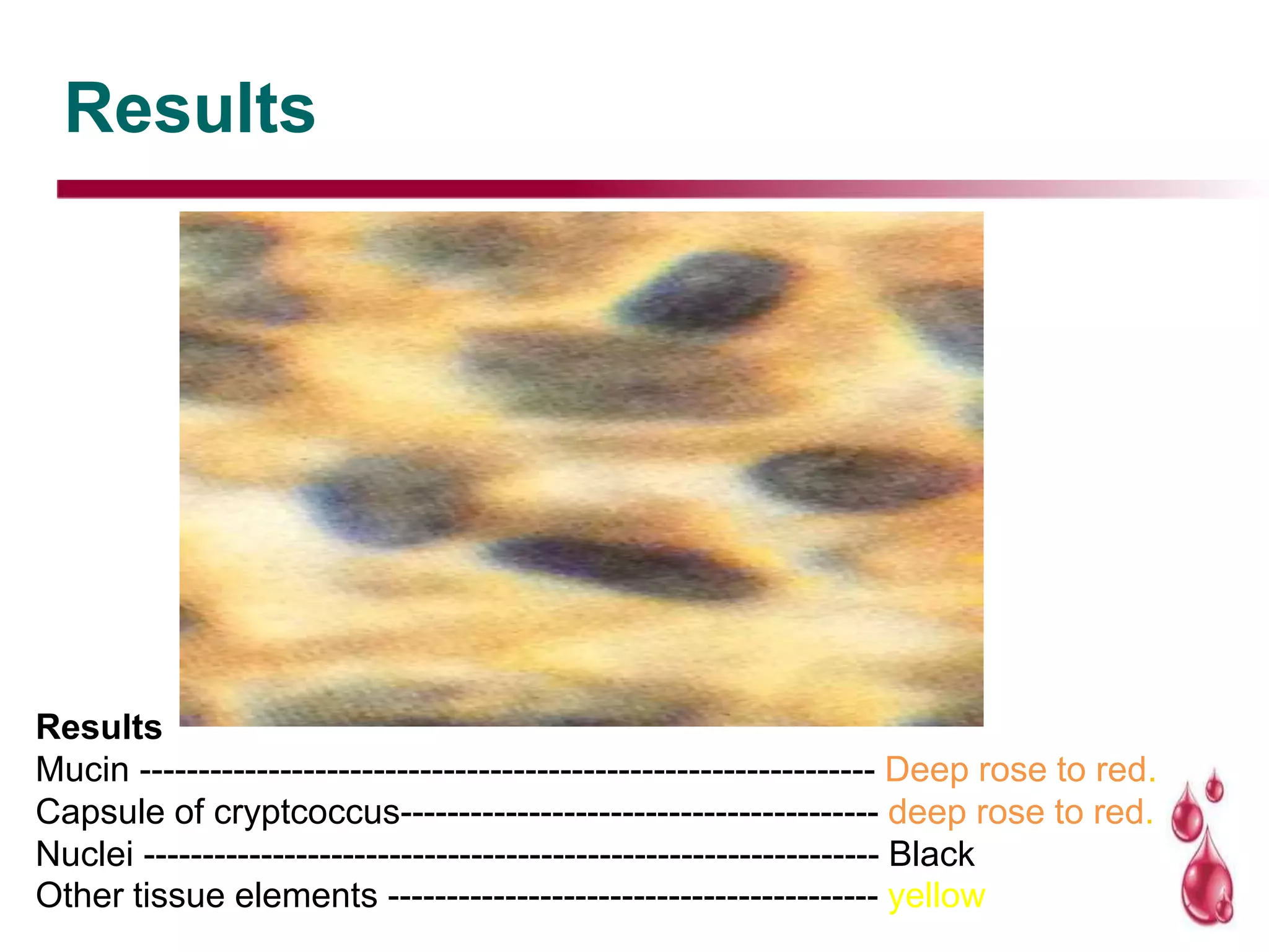 Results
Results
Mucin --------------------------------------------------------------- Deep rose to red.
Capsule of cryptcoccus----------------------------------------- deep rose to red.
Nuclei --------------------------------------------------------------- Black
Other tissue elements ------------------------------------------ yellow
 