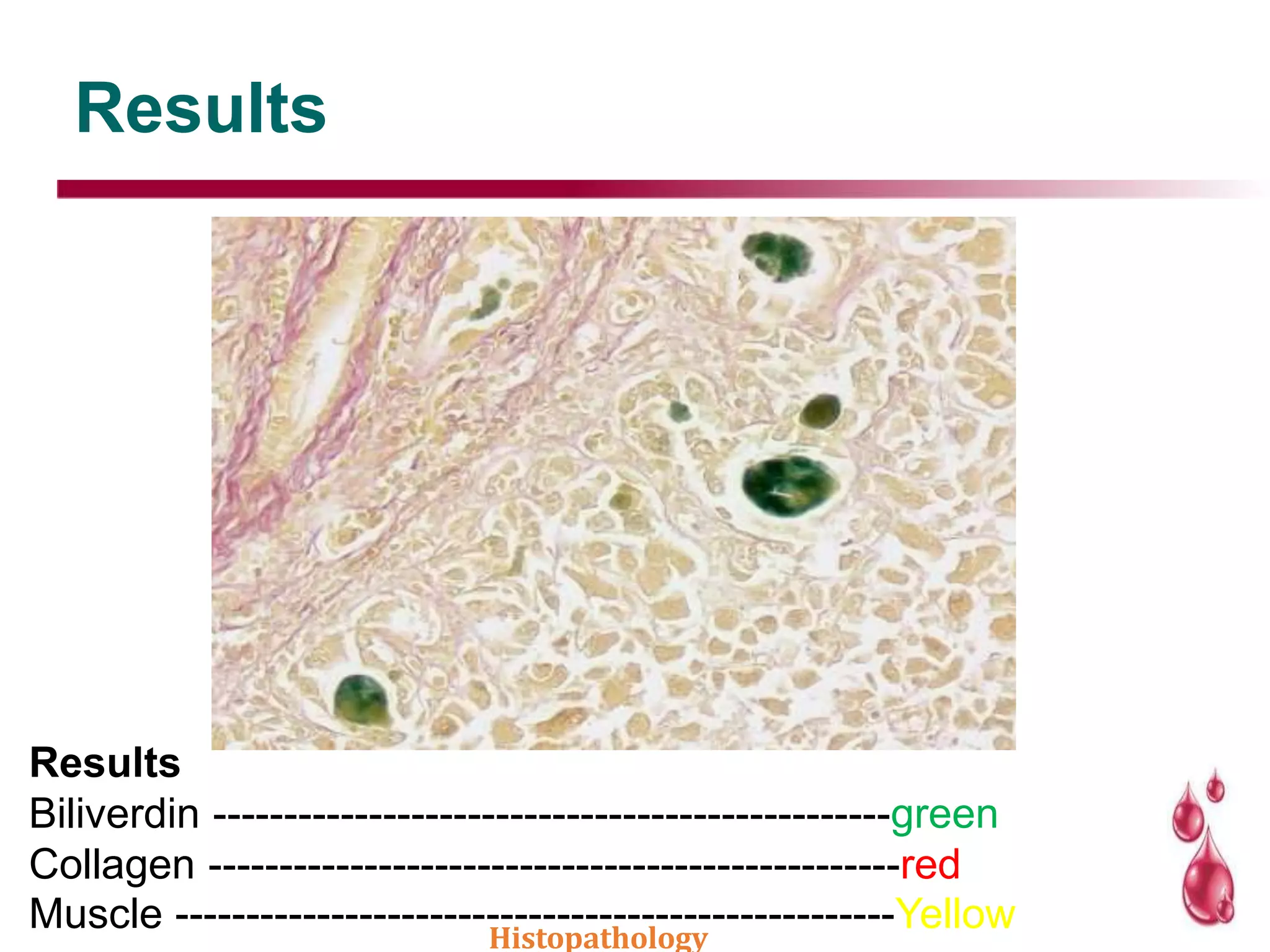 Results
Results
Biliverdin ------------------------------------------------green
Collagen -------------------------------------------------red
Muscle ---------------------------------------------------YellowHistopathology
 
